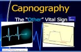 Capnography - The 'Other' Vital - The OTHER Vital Sign.pdf Capnography – The “Other” Vital Sign – 4th Edition . Capnography The 2 Types of Capnometers Mainstream Sidestream