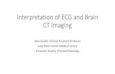 Interpretation of ECG and Brain CT Imagingarmed.org.ua/wp-content/uploads/2019/11/1.ecg-and-image-interpret… · Interpretation of ECG and Brain CT Imaging Zeev Goldik -Clinical