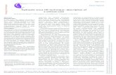 Hydraulic sinus lift technique: description of a clinical case · Hydraulic sinus lift technique: description of a clinical case M Andreasi Bassi1*, MA Lopez1, L Confalone1, S Fanali2,