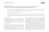 Case Report Lesser Trochanter Migration following Intramedullary …downloads.hindawi.com/journals/crior/2016/9348032.pdf · 2019. 7. 30. · Case Report Lesser Trochanter Migration