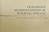 CUTANEOUS MANIFESTATIONS OF INTERNAL DISEASE€¦ · Cutaneous involvement: 30-40% of adults; 95% of children Male=Female Over 50 years higher risk for collagen vascular disease and