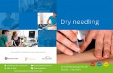 Dry needling - Fysiotherapie · Dry needling is een vrij nieuwe behandelmethode binnen de fysio- therapie, waarbij gewerkt wordt met heel dunne, droge naalden. Er wordt hierbij niets
