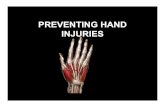 PREVENTING HAND INJURIES - Precast Concrete · 2019. 3. 20. · Hand Injuries To avoid hand injuries: –Know the hazards and dangers in the job to be done –Be aware of pinch points
