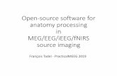 Software for anatomy processing · 2019. 12. 7. · Other anatomy processes •Co-registration between subjects Group-analysis •Registration to MNI space Atlases, comparison with