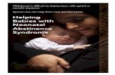 Helping Babies with Neonatal Abstinence  ¢  2020. 8. 11.¢  Neonatal Abstinence Syndrome, or