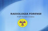 RADIOLOGIA FORENSE - portalidea.com.br · Radiologia Forense Identificação Através da Radiologia Forense Ao encontrar um corpo carbonizado, ou ainda com roupas, é possível, com