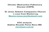 Chronic Obstructive Pulmonary Disease (COPD) Dr Jesus ...cardiolatina.com/wp-content/uploads/2018/09/ECG_DPOC.pdf · was cor pulmonale. Afterwards, the patient was discharged due
