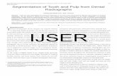 1 INTRODUCTION IJSER...radiographs, and the process is difficult due to noise, low contrast, and uneven illumination of the dental radiographs. For accurate segmentation, images must