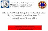 The effect of leg length discrepancy after hip replacement ...poitr.pl/attachments/article/608/15-blacha-katowice-asymetria.pdf · Limb length discrepancy and related problems following
