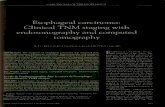 Esophageal carcinoma: Clinical TNM endosonography and L'endosonographie etaic egalement superieure a