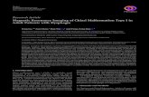 Magnetic Resonance Imaging of Chiari Malformation Type I ...downloads.hindawi.com/journals/bmri/2019/7485010.pdf · ResearchArticle Magnetic Resonance Imaging of Chiari Malformation