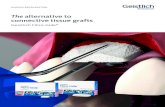 The alternative to connective tissue grafts · Connective Tissue Graft buccal buccal Geistlich Fibro-Gide® shows non-inferior results to connective tissue grafts in terms of change