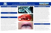 Lingual Thyroid - ResearchPosterslingual thyroid and autotransplantation of lingual thyroid have been described. In patients with a suspected lingual thyroid we advocate thyroid function