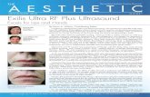 Refresh Dermatology · JULY AUGUST 2016 The Leading Aesthetic Practice Resourcet" GUIDE@ Exilis Ultra RF PIUS Ultrasound Excels for Lips and Hands Before Tx After two BTL Exilis Ultra