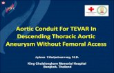 Aortic Conduit For TEVAR In Descending Thoracic Aortic … · Aortic Conduit For TEVAR In Descending Thoracic Aortic Aneurysm Without Femoral Access Apinan Uthaipaisanwong, M.D. King