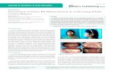 Correction of Class III Malocclusion in a Growing Child: A ... Rapid Maxillary Expansion (RME) along with facemask therapy provides more significant results in correction of class