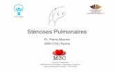 Sténoses Pulmonaires · 2019. 4. 11. · Immediate effects and outcome of in-utero pulmonary valvuloplasty in fetuses with pulmonary atresia with intact ventricular septum or critical