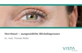 Hornhaut ausgewählte Blickdiagnosen¤sentationen/Plenum_3/Fr… · myopia and astigmatism •Phakic lens implantations leaves cornea unchanged and is therefore ideal for medium to