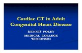 Cardiac CT in Adult Congenital Heart Disease · 2013. 12. 5. · TETRALOGY FALLOT ... Microsoft PowerPoint - Foley - 2011 Presentation Cardiac CT in Adult Congenital Heart Disease.ppt