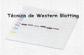 Técnica de Western Blotting - Câmpus de Jaboticabal...Técnica de Western Blotting (Immunoblotting) Método utilizado para a imunodetecção de proteínas após sua separação por