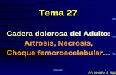 Tema 27...Cadera dolorosa del Adulto: Artrosis, Necrosis… Silió F 27 Otros Procesos Dolorosos • Osteoporosis Transitoria de cadera: dura de 4 a 12 meses y cursa con osteoporosis