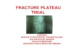 FRACTURE PLATEAU TIBIAL - cours, examens · • Un choc direct sur la région latérale du genou en position de varus entraîne une fracture interne de l’extrémité supérieure