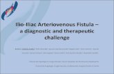 Ilio-Iliac Arteriovenous Fistula a diagnostic and therapeutic ......Ilio-Iliac Arteriovenous Fistula –a diagnostic and therapeutic challenge Authors: Andreia Coelho1, Pedro Brandão1,