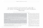 Laminated intestinal calculi – A rare complication of Crohn’s … · 2019. 8. 1. · Laminated intestinal calculi – A rare complication of Crohn’s disease HUGH JFREEMAN MD,ANDREW