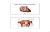 Lecture1 - ECG · 2006. 9. 1. · ECG analysis. 29. Title: Microsoft PowerPoint - Lecture1 - ECG Author: hkaplan Created Date: 9/1/2006 4:06:51 PM ...