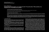 Surgical Extirpation of Apical Left Ventricular Thrombus in ......2 CaseReportsinSurgery I V1 V2 V3 V4 V5 V6 II III aVR aVL aVF Figure 1: Electrocardiogram showed significant ST-elevation