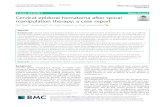 Cervical epidural hematoma after spinal manipulation therapy: a … · 2019. 10. 22. · artery dissection, spinal cord injury, cervical subluxation, and cerebrovascular accidents