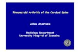 Rheumatoid Arthritis of theCervical Spine Zikou Anastasia ......(edematous spinal cord changes: poor clinical status, poor prognosis & poor postoperative outcome) AAS “pannus”