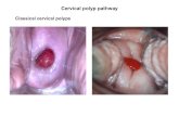 Classical cervical polyps · 2017. 2. 14. · Pathway for management of cervical polyps in primary care • If