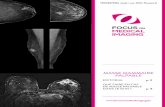 MASSE MAMMAIRE PALPABLE · 2021. 2. 8. · CC et MLO) et une échographie s’imposent. Les hommes (> 25 ans) présentant un nodule palpable sont soumis d’office à une mammo-graphie