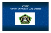 COPD Leads to Cor Pulmonale · 2019. 3. 22. · Two Major Causes of COPD Chronic Bronchitis is characterized by Chronic inflammation and excess mucus production Presence of chronic