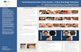 Partial Reconstruction of the Auricle A New One-Stage Technique · 2015. 9. 23. · Introduction: Auricular reconstruction after traumatic ear loss remains a challenge in Otolaryngology