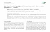 Case Report Three-Dimensional CT Findings of Os Calcaneus ...