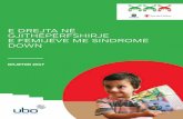 E Drejta Në Gjithëpërfshirjen E Fëmijëve Me Sindromën Down