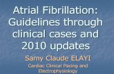 Atrial Fibrillation: Guidelines through clinical cases and ...