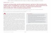 Limb ischemia and pulmonary artery thrombosis afer the ...