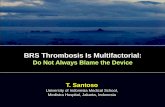 BRS Thrombosis Is Multifactorial
