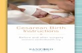 Cesarean Birth Instructions - Sanford Health