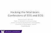 Hacking the fetal brain: Confessions of EEG and ECG
