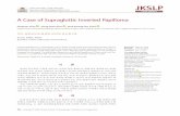 A Case of Supraglottic Inverted Papilloma