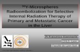 90Y-Microspheres Radioembolization for Selective - NUCLEUS