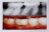 The Internationai Journal ot Periodontics & Restorative Dentistry