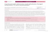 Corticotroph adenoma and pituitary fungal infection: a ...