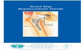 Total Hip Replacement Guide - Cappagh National Orthopaedic
