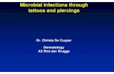 Microbial infections through tattoos and piercings