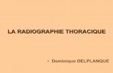 LA RADIOGRAPHIE THORACIQUE - delplanque-formation.com